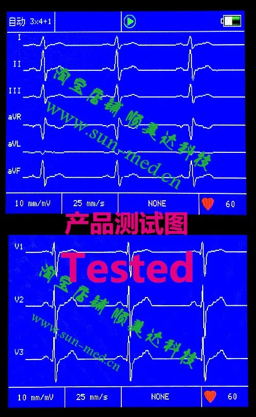 testing2-2