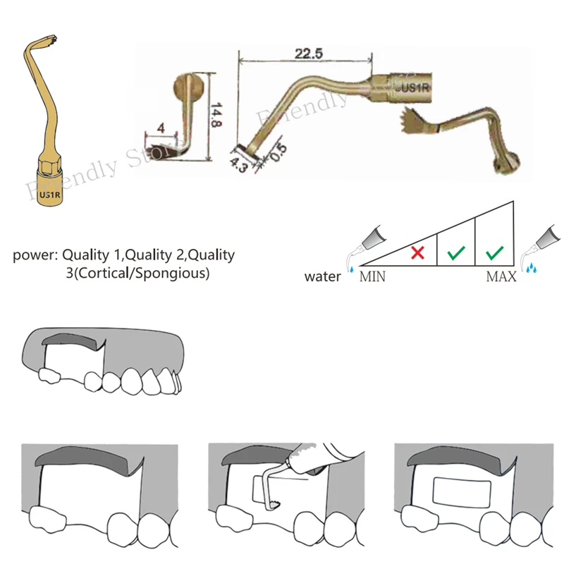 Угловые 3 шт. US1R Ultrasurgery Совет зубов Уход для MECTRON и Дятел Piezosurgery оборудования идеальной улыбки Фанера инструменты