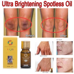 Natural 10Ml / 30Ml Puro Natural Aclarado Esencial Aceite Impecable Manchas Oscuras Se Desvanecen Manchas de la Edad Pigmentación Aceite Esencial Natural 10Ml / 30Ml Puro Natural Aclarado Esencial Aceite Impecable Manchas Oscuras Se Desvanecen Manchas de la Edad Pigmentación Aceite Esencial