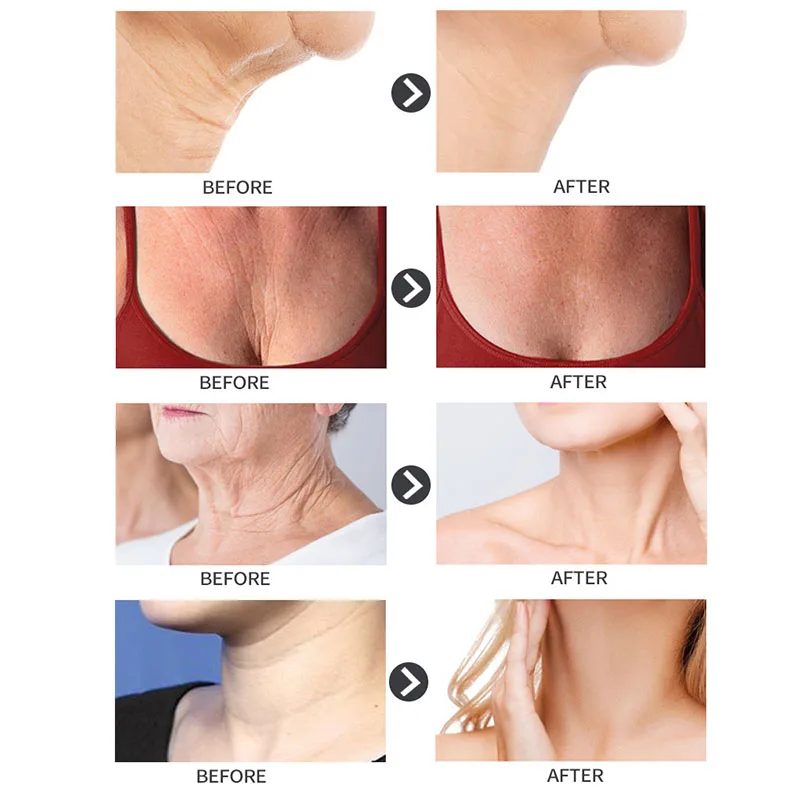 78 г Для женщин анти-морщинки крем для шеи антивозрастной лифтинг, укрепление ремонт груди линии шеи мелкие морщинки крем SK88
