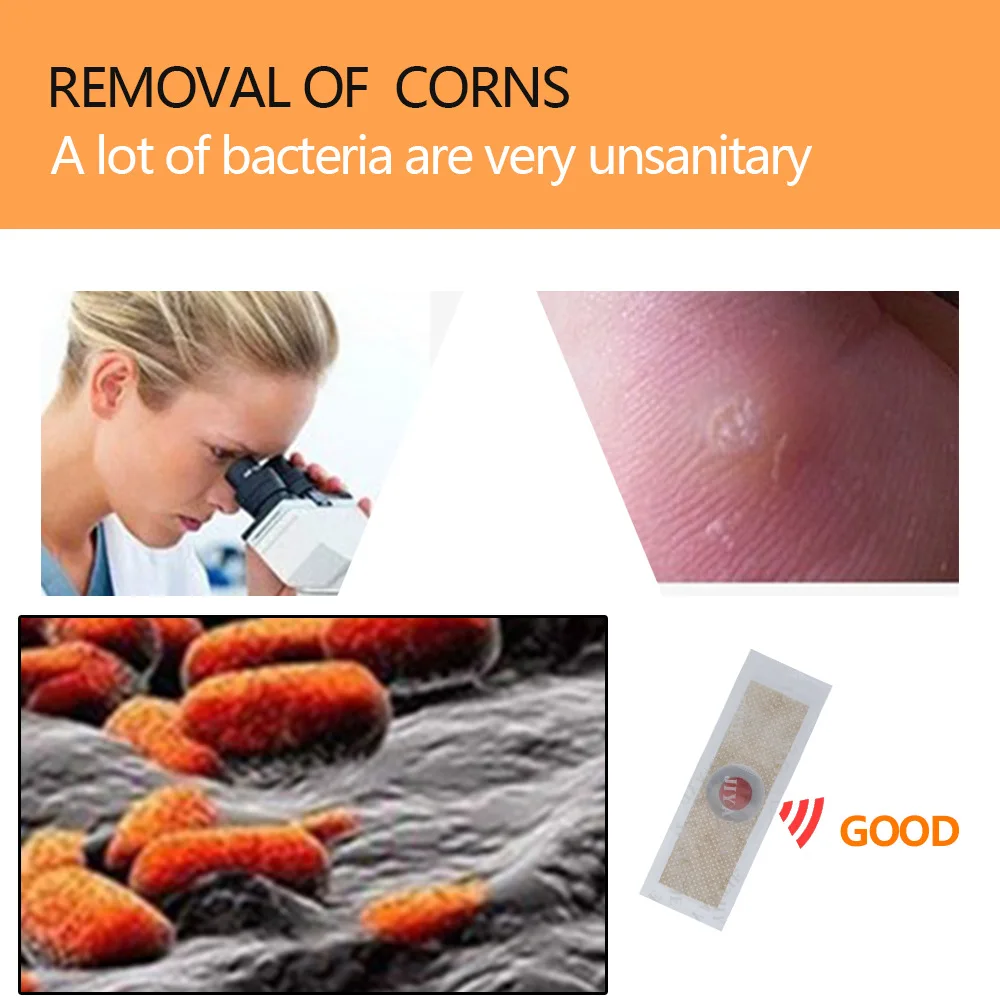 40PcsLot Medical Plaster Foot Corn Removal Calluses Plantar Warts Thorn Plaster Health Care For Relieving Pain-1