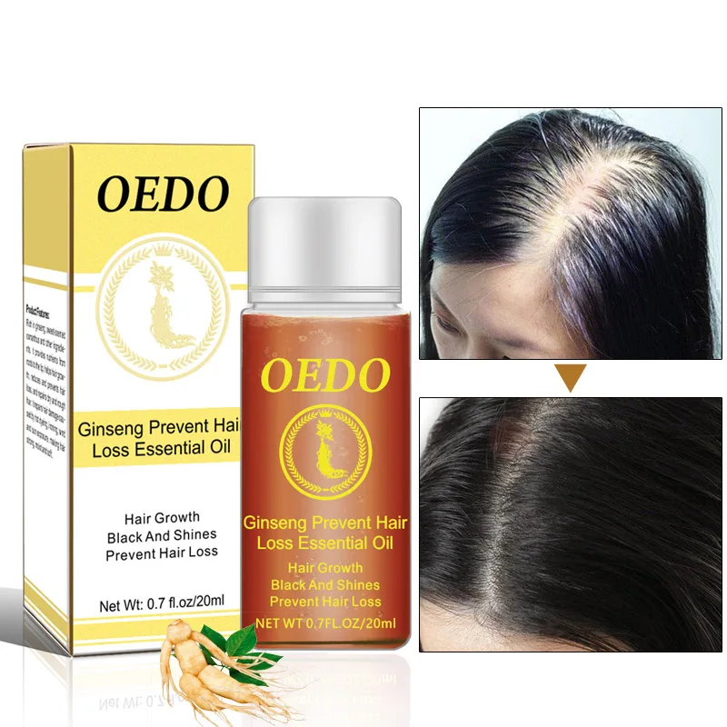 Hair Care Essential Oil Essence Nourishes 20ml Prevention Hair Loss For Repairing Damaged JIU55