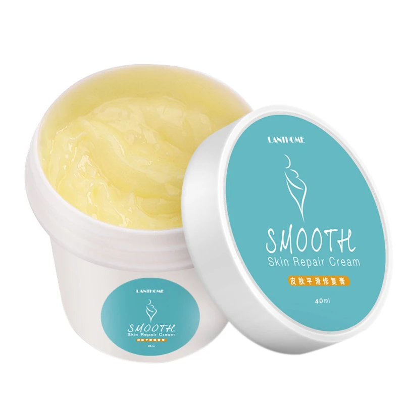 

Lanthome Smooth Skin Repair Cream Remove Pregnancy Scars Acne Cream Stretch Marks Treatment Maternity Repair Anti-Aging Anti W