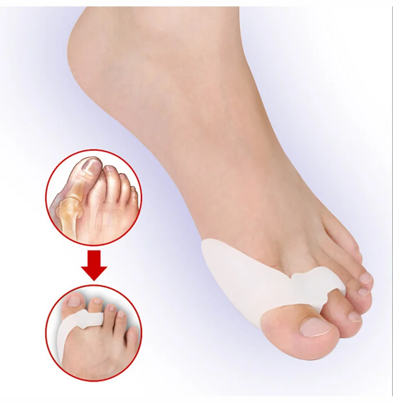 

Bittb 2Pairs Silicone Gel Bunion Corrector Toe Separation Orthopedic Hallux Valgus Foot Care Tool Toe Stretchers Spreader Spacer