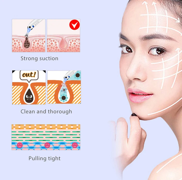 Removedor de Sucção a Vácuo para Aspirador de pó para Limpeza Facial Pore Cleaner Cravo Acne Pimple Remover Tool Pontos Pretos 13 Beleza e saúde