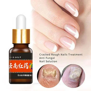 

Fungal Nail Treatment Nail Repair Essence Serum Remove Onychomycosis Hands, Feet Care of Toe Nail Nourishing Brighten 2019