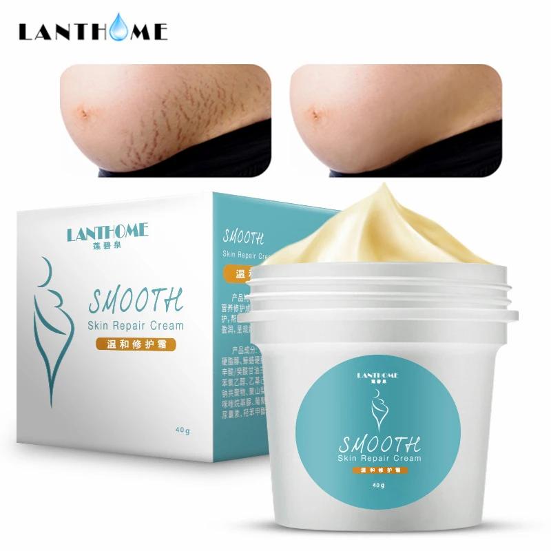 

Stretch Marks Remover Pregnancy Scars Treatment Ance Cream Maternity Skin Repair Anti Aging Anti Winkles Firming Body Care 40g