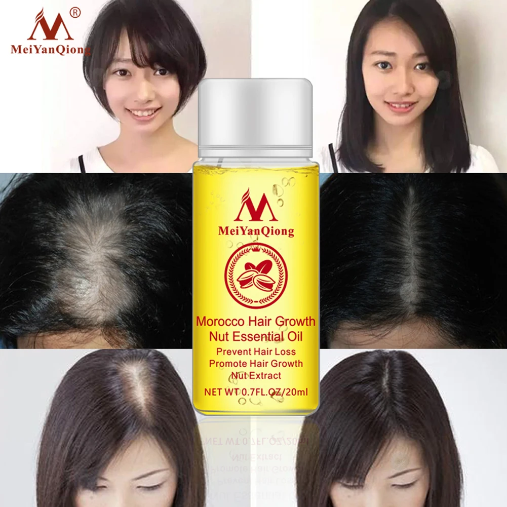 20 мл естественное постоянное увеличение защищает поврежденные волосы для Сушеные Орехи Уход за волосами аромат роста волос эфирное масло