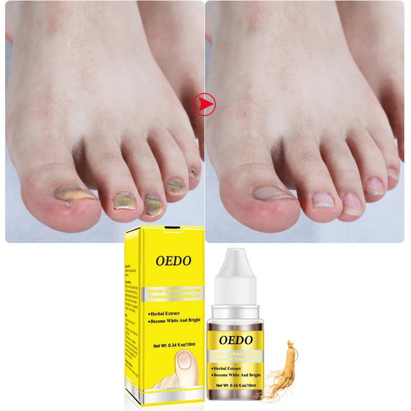 

10ml Bactericidal Natural Essence Oil Nail Liquid Repair Treatment Nail Toe Fungus Removal Moisturizing for Nail Foot Care TSLM2