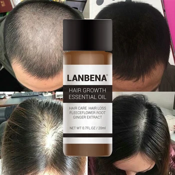

LANBENA Fast Powerful Hair Growth Essence Oil for Men Women Preventing Hair Loss Care Products 20ml