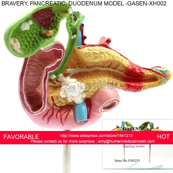 

SURGERY MEDICAL PANCREATIC DIGESTIVE SURGERY GALLSTONES GALLBLADDER PATHOLOGY HEPATOBILIARY GASTROINTESTINAL MODEL GASEN-XH002