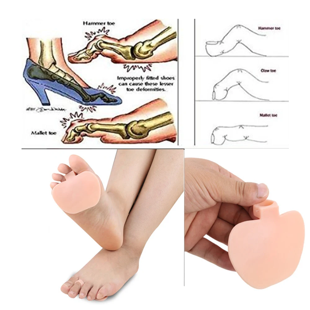 2 шт., силиконовый гель, ортопедические плюсневые кольца, молоток, разделитель для коррекции пальцев ног, выпрямитель для ухода за ногами, обувь, подушечки Z32601