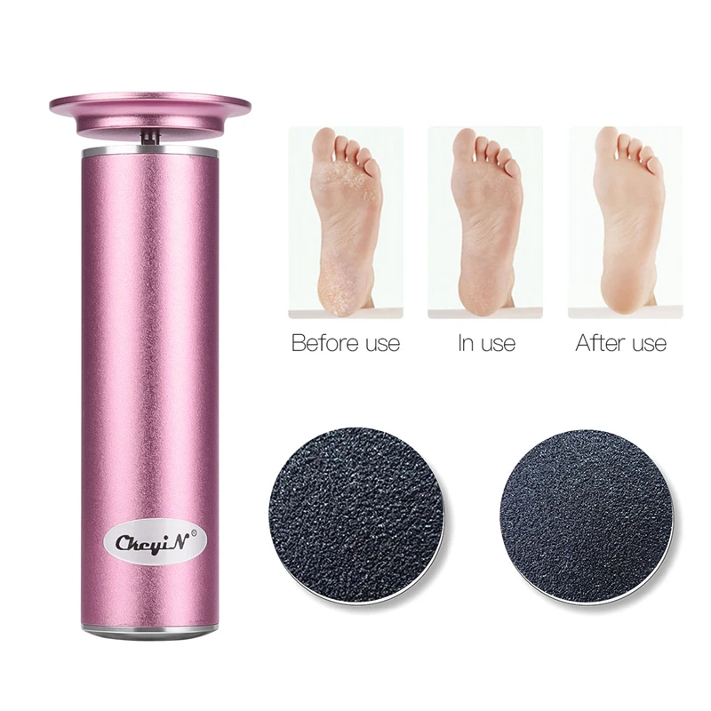 Smoother + 60 Conjunto Pedicure Foot Care Arquivo Morto Pele Dura Callus Remover Ferramentas Pés Heel Sander - 120 Pcs Lixa 46 9 Instrumento cuidados c/ pés