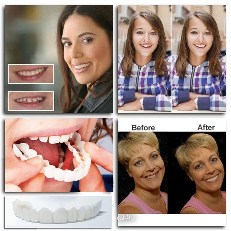 Perfect-Smile-Veneers-Comfort-Fit-Flex-Teeth-Fits-Most-Comfortable-False-Teeth-Upper-Cosmetic-Fake-Tooth