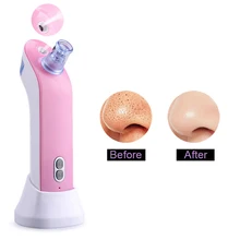 2в1 вакуумное устройство для удаления черных точек лица прибор для парообразования использует консилер инструмент для очистки пор ручка Гвоздика экстрактор красота инструмент