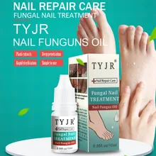 Лечение онихомикоза для ногтей, удаление грибка