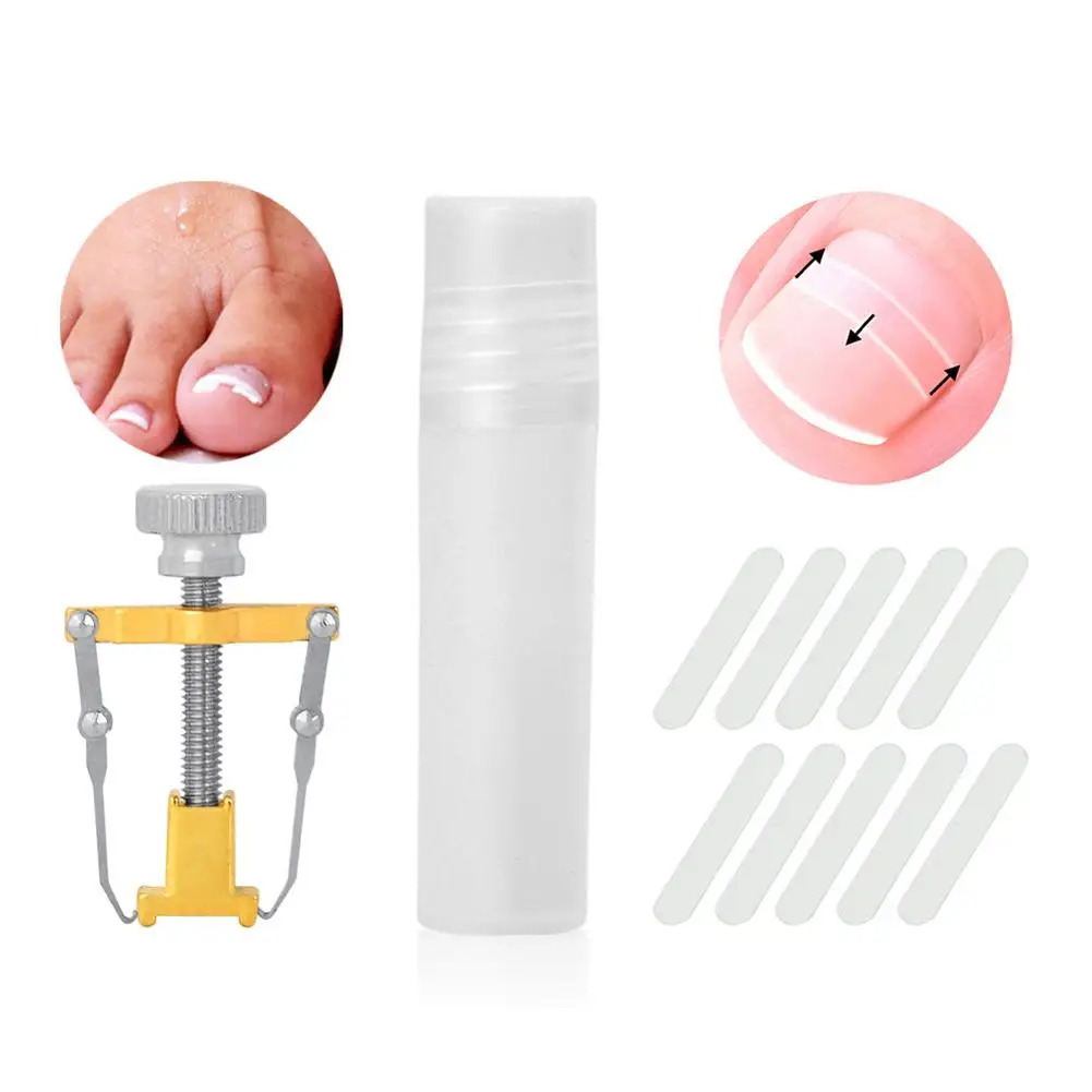 

Hot Ingrown Toenail Straightening Correction Tools Foot Nails Pasters Kit Pedicure
