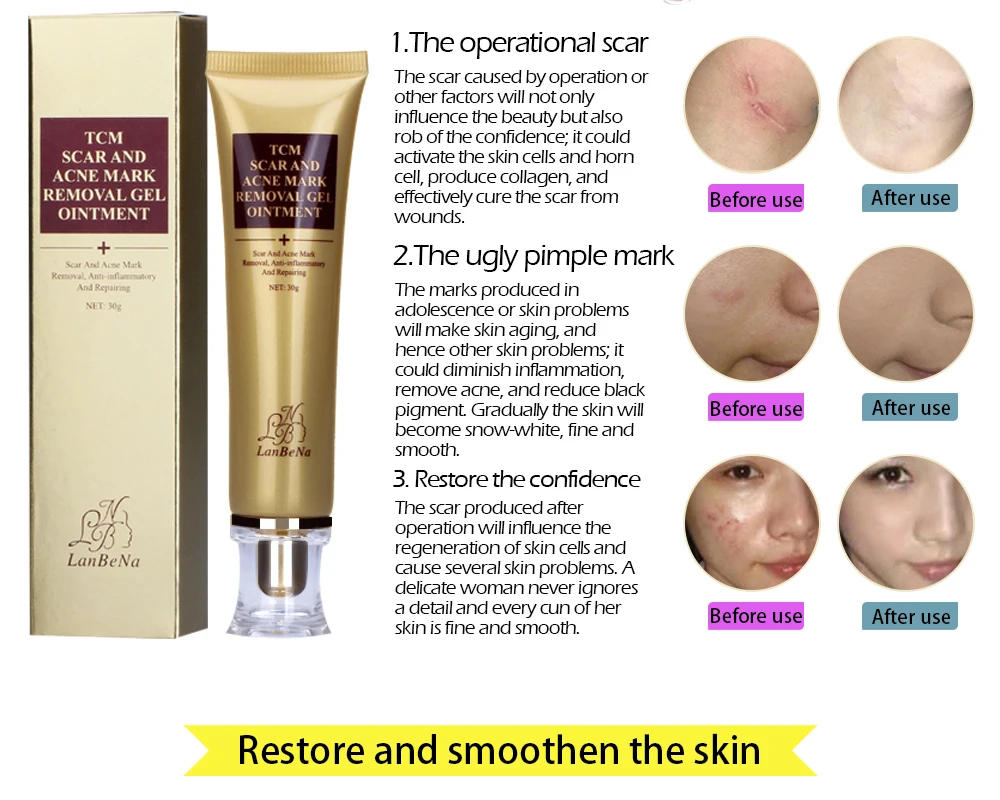 30g Ginseng Acne Scar Removal Cream Skin Repair Treatment Cream Against Scar Acne Mark Face Care Whitening Cream TSLM2
