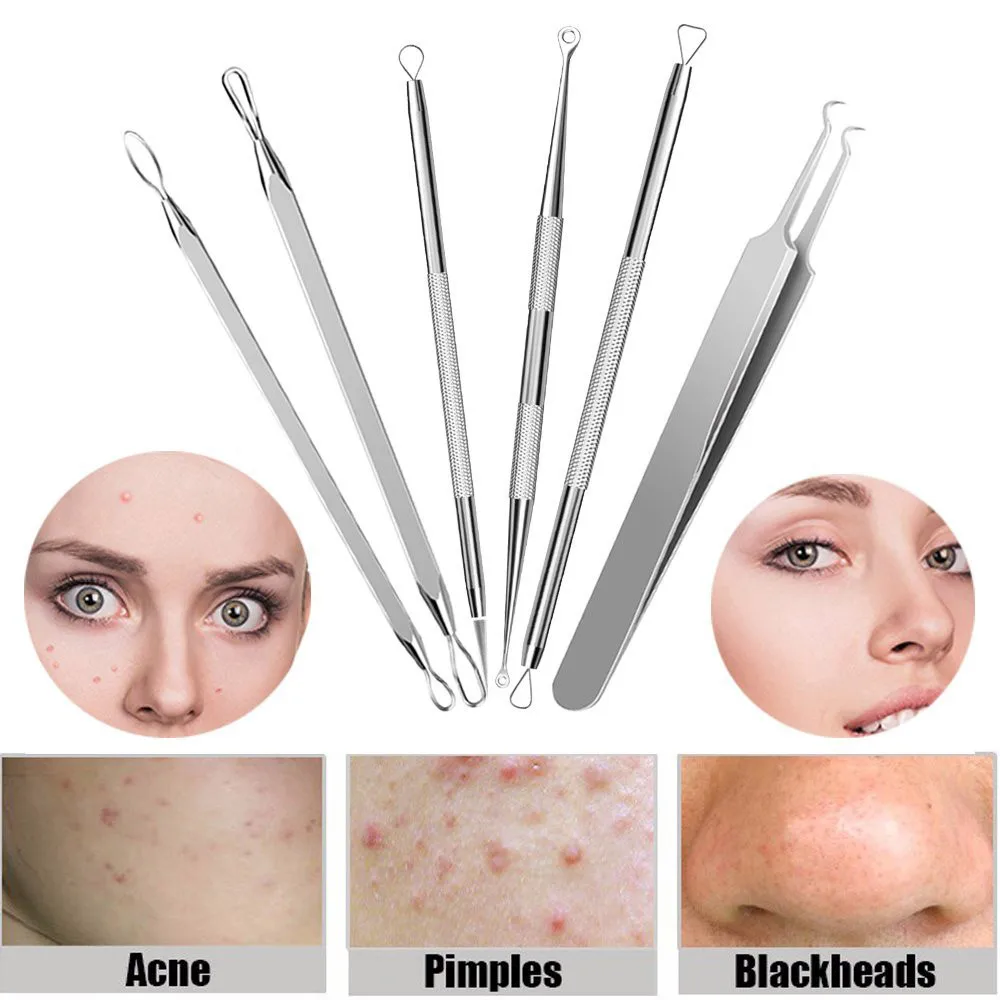 6PCS Stainless steel blackhead pimples acne needle tool Kit with Bag