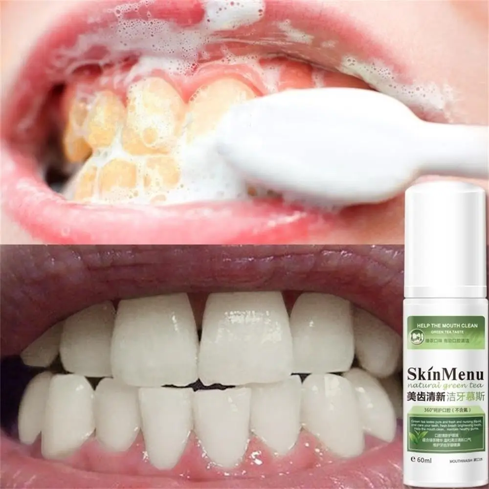 Teeth Cleaning Mousse Fresh Tone Remove Tooth Stains Eliminate Bad