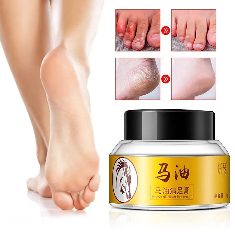 2pcs Useful Horse Oil Hand Foot Crack Cream Heel Chapped Peeling Foot Hand Repair Anti Dry Crack Skin Ointment Cream 30g C3 2pcs Useful Horse Oil Hand Foot Crack Cream Heel Chapped Peeling Foot Hand Repair Anti Dry Crack Skin Ointment Cream 30g C3