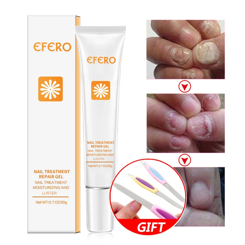 EFERO против грибка ногтей Лечение онихомикоза Paronychia анти грибковое лечение ноги лечение инфекции ногтей эссенция 20 г