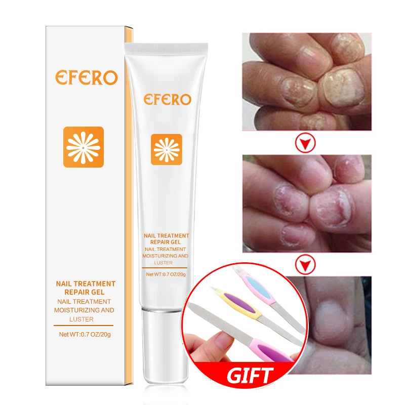

EFERO Anti Nail Fungus Treatment Onychomycosis Paronychia Anti Fungal Treatment Toe Nail Infection Treatment Essence 20g