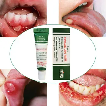 

1pcs Mouth Ulcer Relief Gel Natural Herbal Oral Antibacterial Cream Fast Relief from Severe Pain & Irritation Oral Care