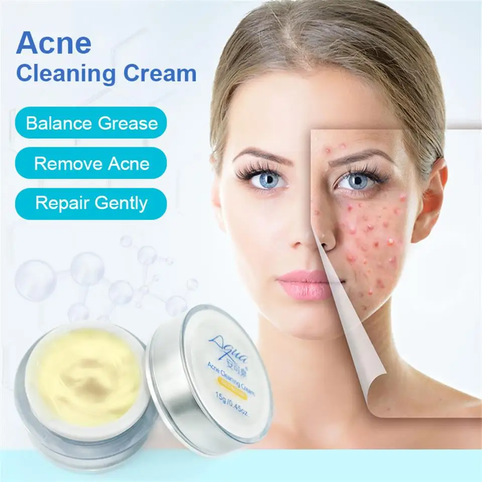 acne treatment for women