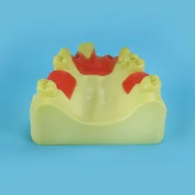 Oral model, maxillary anterior missing implant practice model, dental implant model
