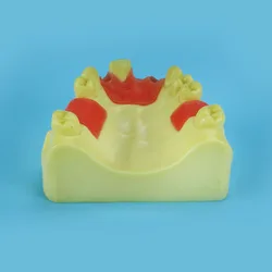Oral model, maxillary anterior missing implant practice model, dental implant model