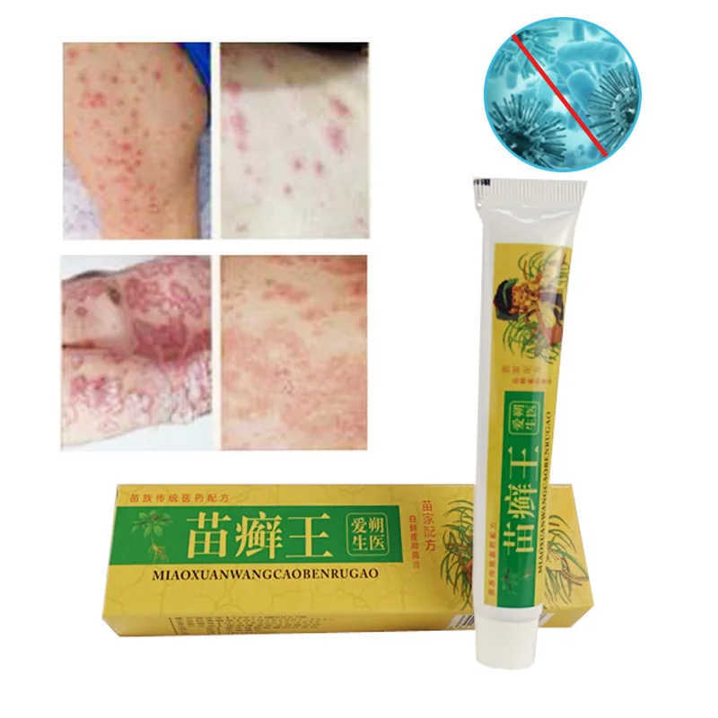 

DUS Body Herbal Material Psoriasis Creams and Eczema Psoriasis Ointment Skin Care Health Products Patches