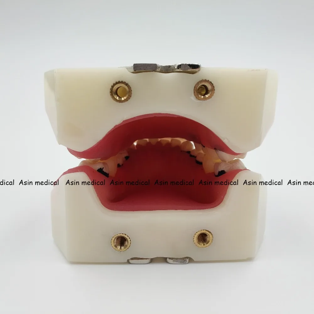 Modelo de Aprendizagem Modelo de Doença Deasin Novo Dentista Periodontal Dente - Modelo Médico 10 Deasin novo modelo de aprendizagem dentista, modelo