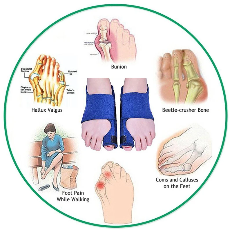 2pcs Bunion Corrector Splint Toe Straightener Brace Hallux Valgus Pain Relief Foot Care Hallux Valgus Corrector Orthopedic Tool