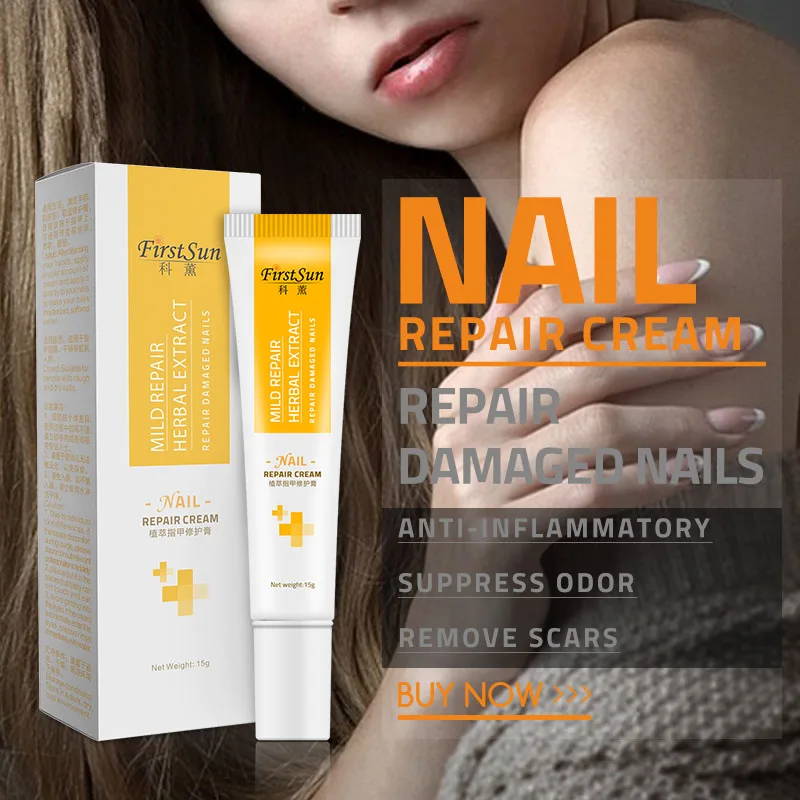 Natural Plant Antibacterial Nail Treatment Cream Nails Fungus Repair Toe Nail Care Cream Effective Onychomycosis Treatment Cream
