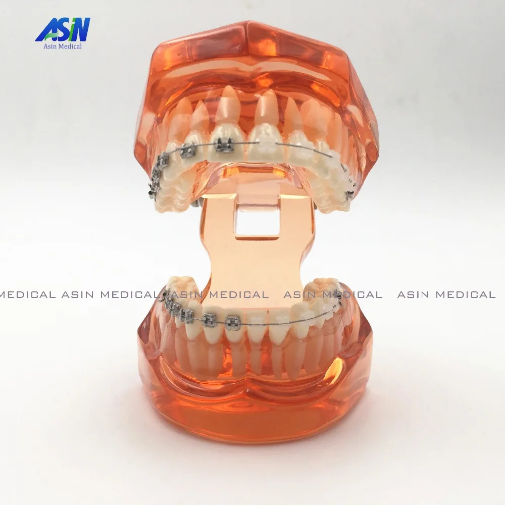 2016 new High quality Orthodontists model With metal & ceramic brackets