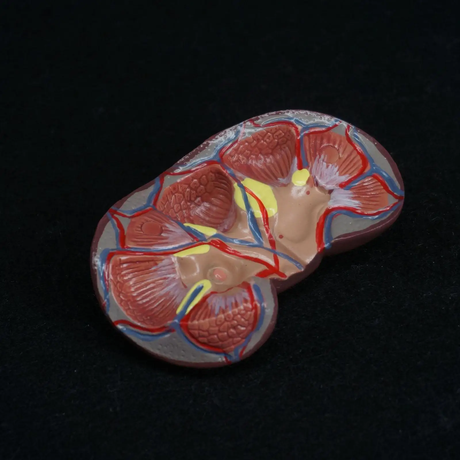 PVC Human Kidney with Adrenal Gland Anatomical Medical Model Urology Anatomy Natural Life Size