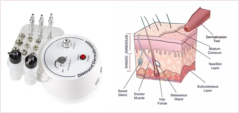 3 в 1 алмазная микродермабразия вакуумный спрей машина инструмент для очистки кожи