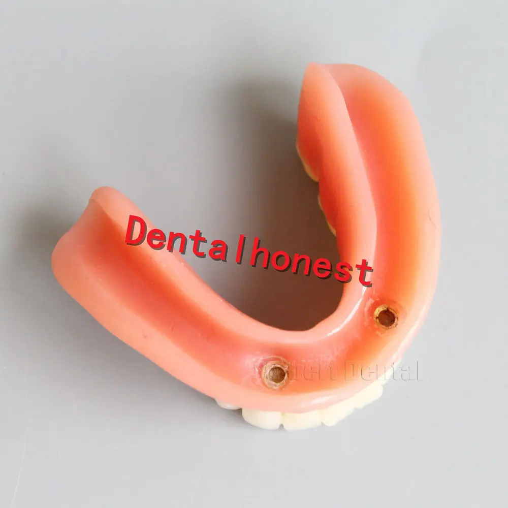 Зубной имплантат с нижним протезом 6007 зубы модель 2 имплантаты модель зуба