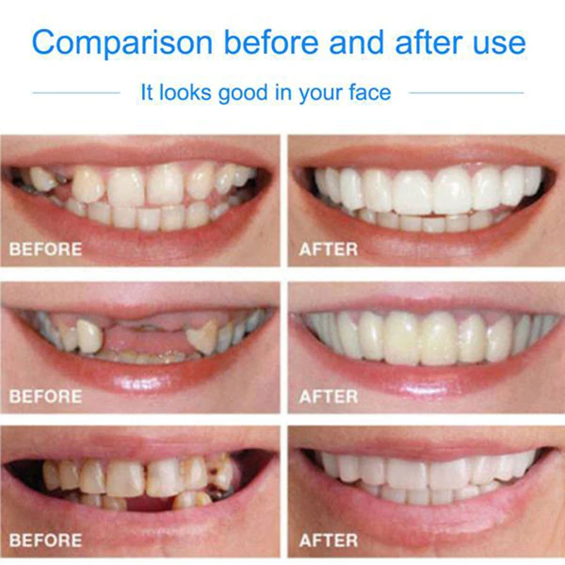 

Drop Ship Smile Maker Fit Flex Teeth with Box Fits Snap on Smile False Teeth Upper Fake Tooth Cover Perfect Smile Veneers