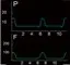 BMC GII BPAP T-25A/T-25T Электрический Bilevel CPAP Машина для апноэ копд храп с пульсоксиметром маска для лица шланг увлажнитель