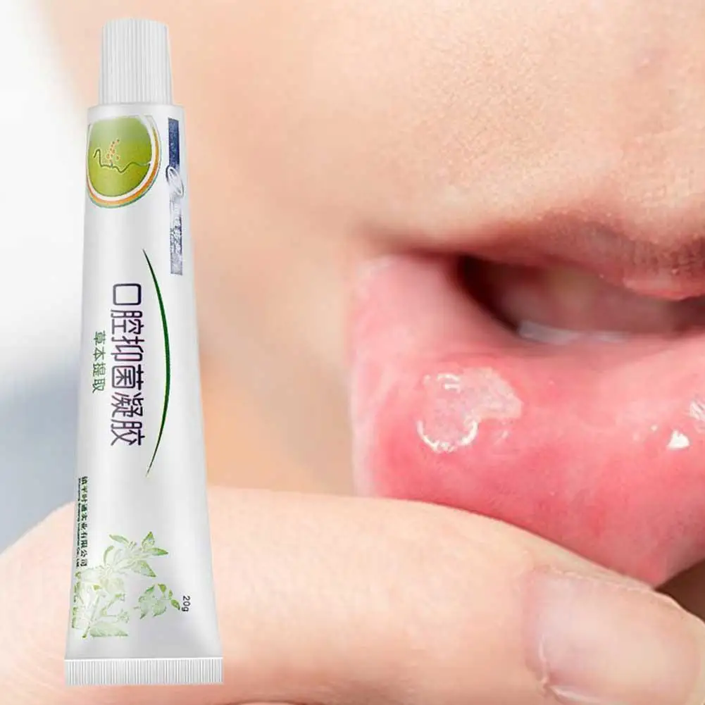 Облегчение язвы рта гель натуральный травяной оральный Антибактериальный крем быстрое облегчение от сильной боли и раздражения лечение язв полости рта