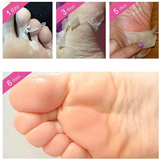 

No Salicylic Acid Nourished Exfoliator Foot Mask Heel Feet Care Peeling Cuticles Whitening Callus Hard Dead Health Skin Care
