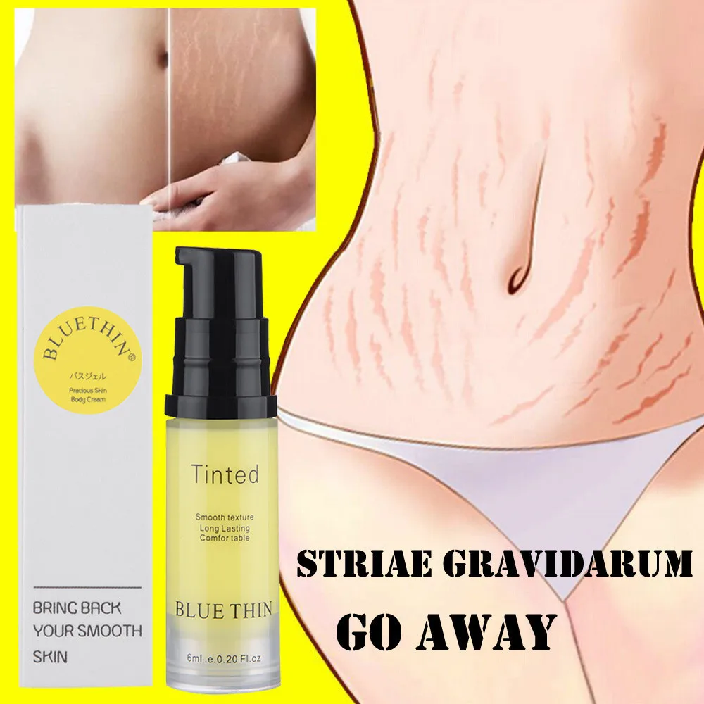 6ML Striae Repair Cream Removal Scar Stretch Marks Cream Fat Scar Striae Gravidarum Treatment