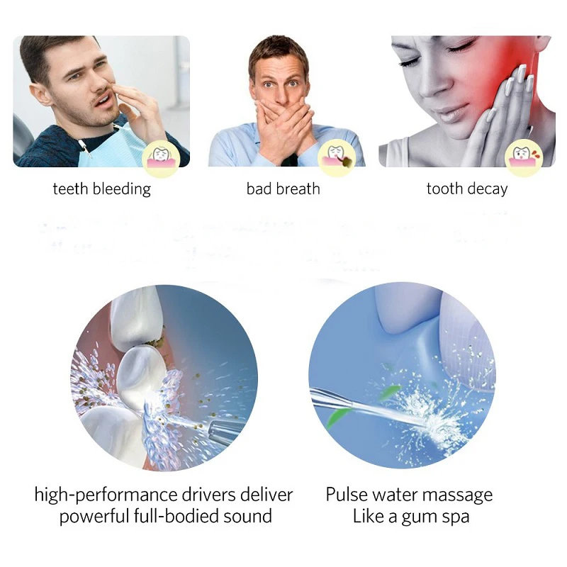Replacement Jet Tips Nozzles For Water Flosser Compatible With Waterpick / Nicefeel Flycat Oral Irrigator Effective Oral Care oral irrigator,water flosser