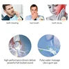 Embouts de remplacement pour hydropulseur, pour hydropulseur buccal, Compatible avec Waterpick / Nicefeel Flycat, irrigateur buccal efficace ► Photo 3/6