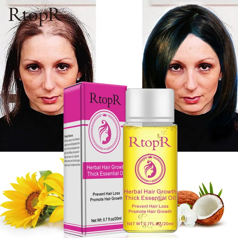 RtopR, 20 мл, жидкость для защиты от выпадения волос, стимулирует рост густых и быстрых волос, эфирное масло, забота о здоровье, красота, эссенция