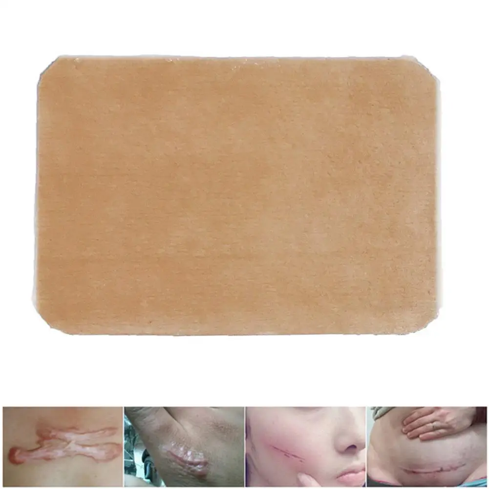 

Waterproof Silicone Scars Removing Patch Self Adhesive Wound Mark Spot Sheet Pad