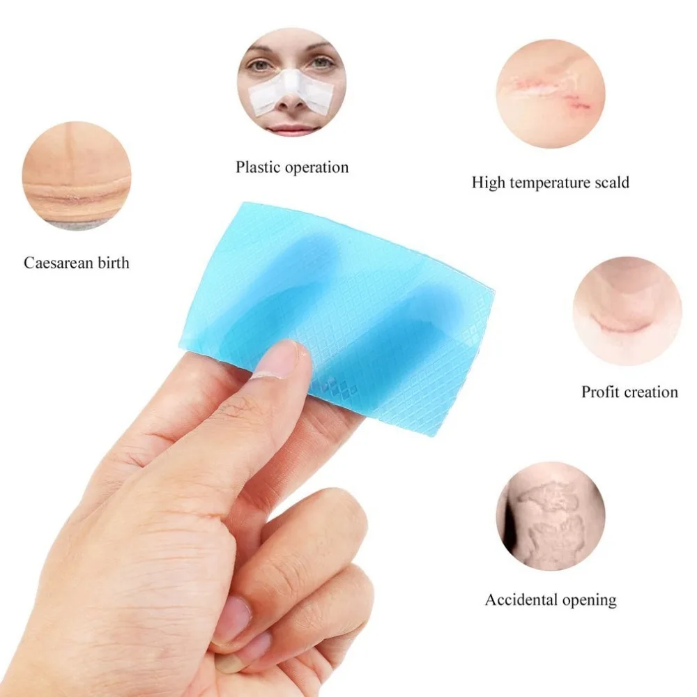 Silicone Scar Gel Away Strips Paste Medical Trauma Burn Scar Sheet Skin
