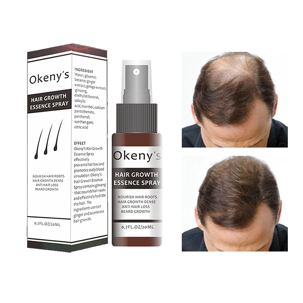 1 шт. 20 мл Уход за волосами эссенция для роста лечение выпадения волос эссенция для роста спрей эффективно способствует циркуляции крови головы TSLM1
